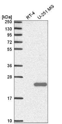 Western Blot: C9orf9 Antibody [NBP2-58670] - Western blot analysis in human cell line RT-4 and human cell line U-251 MG.