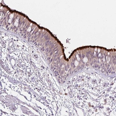 Immunohistochemistry-Paraffin: C9orf9 Antibody [NBP2-58670] - Immunohistochemical staining of human bronchus shows strong membranous positivity in respiratory epithelial cells / Cilia strongly stained.
