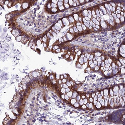Immunohistochemistry-Paraffin: Adiponectin Receptor 2 Antibody [NBP1-91652] Staining of human colon shows moderate cytoplasmic positivity in glandular cells.