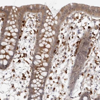 Immunohistochemistry: C1orf158 Antibody [NBP1-81097] - Immunohistochemical staining of human colon shows cytoplasmic positivity in glandular cells.