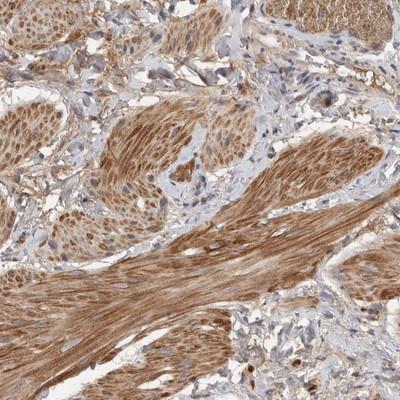 Immunohistochemistry: Muscarinic Acetylcholine Receptor M3/CHRM3 Antibody [NBP1-87547] - Staining of human smooth muscle shows moderate cytoplasmic positivity in muscle cells.