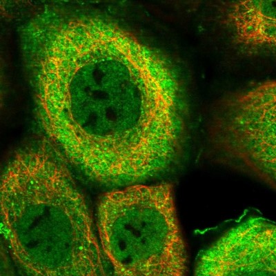 Immunocytochemistry/Immunofluorescence: DNAJB4 Antibody [NBP1-81736] - Immunofluorescent staining of human cell line A-431 shows localization to nucleoplasm, plasma membrane & cytosol.