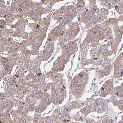 Immunocytochemistry/Immunofluorescence: Guanylyl Cyclase alpha 1 Antibody [NBP2-49210] - Staining of human parathyroid gland shows moderate cytoplasmic positivity in glandular cells.