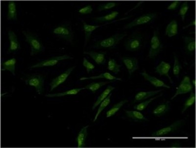 Immunocytochemistry/Immunofluorescence: MYCBP Antibody (2E9) [H00026292-M02] - Analysis of monoclonal antibody to MYCBP on HeLa cell. Antibody concentration 10 ug/ml.