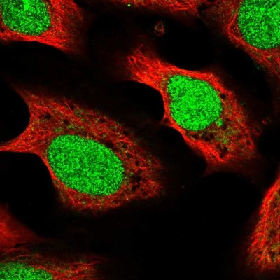 Immunocytochemistry/Immunofluorescence: METT11D1 Antibody [NBP2-54746] - Immunofluorescent staining of human cell line U-2 OS shows localization to nucleus.