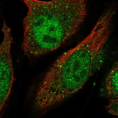 Immunocytochemistry/Immunofluorescence: LGSN Antibody [NBP2-58511] - Staining of human cell line U-2 OS shows localization to nucleoplasm & vesicles.