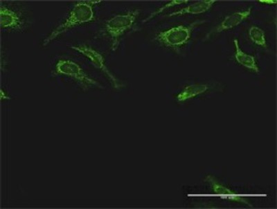 Immunocytochemistry/Immunofluorescence: DLST Antibody [H00001743-D01P] - Analysis of antibody to DLST on HeLa cell. Antibody concentration 10 ug/ml.