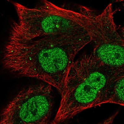 Immunocytochemistry/Immunofluorescence: RRAGD Antibody [NBP2-55736] - Staining of human cell line SK-MEL-30 shows localization to nucleoplasm & centrosome.