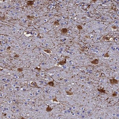 Immunohistochemistry-Paraffin: Synaptotagmin 13 Antibody [NBP1-92466] - Staining of human cerebral cortex shows strong cytoplasmic positivity in neuronal cells.