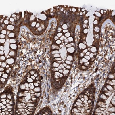 Immunohistochemistry-Paraffin: Importin4 Antibody [NBP1-89841] - Staining of human colon shows strong cytoplasmic positivity in glandular cells.