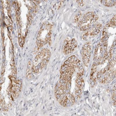 Immunohistochemistry: C1orf172 Antibody [NBP1-93838] - Staining of human seminal vesicle shows cytoplasmic positivity in glandular cells.