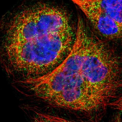 Immunocytochemistry/Immunofluorescence: MAP4K2 Antibody [NBP1-88584] - Immunofluorescent staining of human cell line A-431 shows localization to vesicles.