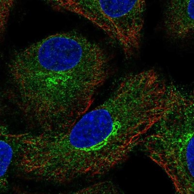 Immunocytochemistry/Immunofluorescence: AMFR/gp78 Antibody [NBP2-57987] - Staining of human cell line A549 shows localization to endoplasmic reticulum & the Golgi apparatus.