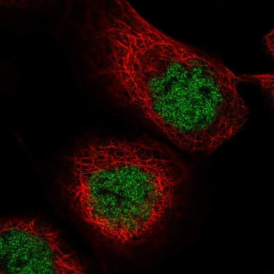 Immunocytochemistry/Immunofluorescence: MASTL Antibody [NBP2-55023] - Staining of human cell line A-431 shows localization to nucleoplasm.