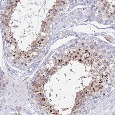 Immunocytochemistry/Immunofluorescence: GLB1L Antibody [NBP1-81235] - Staining of human testis shows strong nuclear and cytoplasmic positivity in seminiferous ducts.