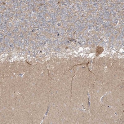 Immunocytochemistry/Immunofluorescence: TRIM2 Antibody [NBP1-81505] - Staining of human cerebellum shows cytoplasmic positivity Purkinje cells.
