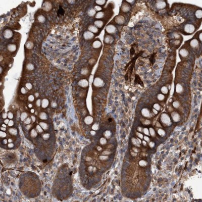 Immunocytochemistry/Immunofluorescence: GGT6 Antibody [NBP1-81883] - Staining of human colon shows strong cytoplasmic positivity in glandular cells.