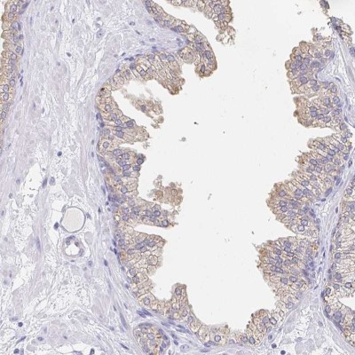 Immunocytochemistry/Immunofluorescence: PDE6 beta Antibody [NBP2-56205] - Immunohistochemical staining of human prostate shows weak cytoplasmic positivity in glandular cells.