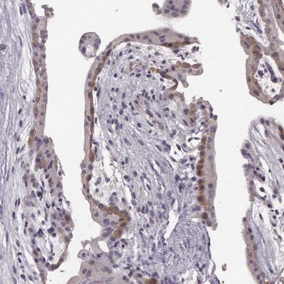 Immunocytochemistry/Immunofluorescence: GPR50 Antibody [NBP2-56258] - Immunohistochemical staining of human placenta shows moderate positivity in a subset of trophoblastic cells.