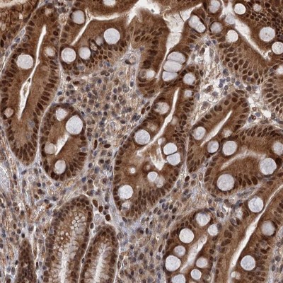 Immunocytochemistry/Immunofluorescence: NEK8 Antibody [NBP1-82540] - Staining of human stomach shows strong nuclear and cytoplasmic positivity in glandular cells.