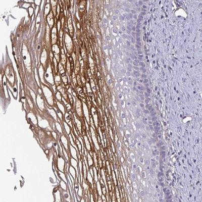 Immunohistochemistry: ECM-1/Secretory Component P85 Antibody [NBP1-87449] - Immunohistochemical staining of human vagina shows strong cytoplasmic positivity in subset of squamous epithelial cells.