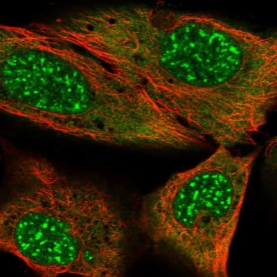 Immunocytochemistry/Immunofluorescence: MYST3 Antibody [NBP2-57745] - Staining of human cell line U-2 OS shows localization to nuclear speckles & cytosol.