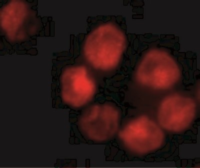 Immunocytochemistry/Immunofluorescence: ADAM10 Antibody [NBP1-76973] - Immunofluorescence of ADAM10 in K562 cells with ADAM10 antibody at 10 ug/mL.