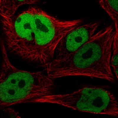 Immunocytochemistry/Immunofluorescence: SOX10 Antibody [NBP2-57023] - Staining of human cell line SK-MEL-30 shows localization to nucleoplasm.