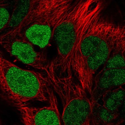Immunocytochemistry/Immunofluorescence: SCL/Tal1 Antibody [NBP2-56907] - Staining of human cell line CACO-2 shows localization to nucleus.