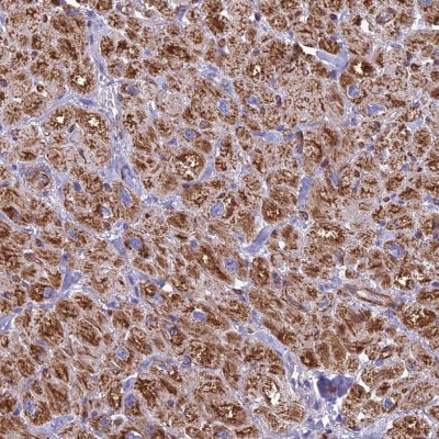 Immunocytochemistry/Immunofluorescence: POMGNT1 Antibody [NBP1-82193] - Staining of human heart muscle shows cytoplasmic positivity in myocytes.