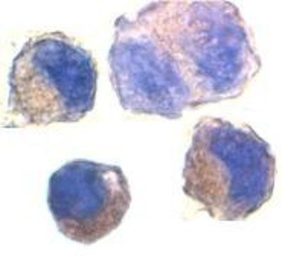 Immunocytochemistry/Immunofluorescence: ADAM10 Antibody [NBP1-76973] - K562 cells using ADAM10 antibody at 2 ug/ml.