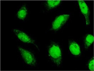 Immunocytochemistry/Immunofluorescence: RNF165-IT1 Antibody (3A1) [H00147341-M01] - Analysis of monoclonal antibody to C18orf23 on HeLa cell. Antibody concentration 10 ug/ml.