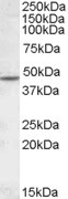 Western Blot: Nicotinic Acetylcholine Receptor beta 2 Antibody [NBP1-28467] - Analysis of Nicotinic Acetylcholine Receptor beta 2 in Human Cerebellum lysate (35ug protein in RIPA buffer) using NBP1-28467 at 1ug/ml. Primary incubation was 1 hour. Detected by chemiluminescence.