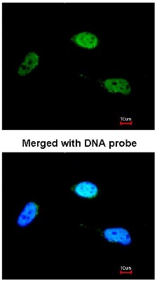 Immunocytochemistry/Immunofluorescence: ZNF398 Antibody [NBP1-31317] - Analysis of HeLa, using ZNF398 antibody at 1:200 dilution.