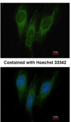 Immunocytochemistry/Immunofluorescence: DNAJC1 Antibody [NBP1-32448] - Analysis of methanol-fixed HeLa, using antibody at 1:200 dilution.