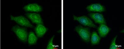 Immunocytochemistry/Immunofluorescence: FASTKD1 Antibody [NBP1-32639] - MCF-7 cells were fixed in ice-cold MeOH for 5 min. Green: FASTKD1 protein stained by FASTKD1 antibody [C1C3] diluted at 1:500. Blue: Hoechst 33342 staining.