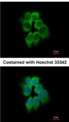 Immunocytochemistry/Immunofluorescence: actin-related protein 2/3 complex subunit 1B Antibody [NBP2-15262] - Analysis of methanol-fixed A431, using antibody at 1:500 dilution.