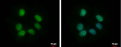 Immunocytochemistry/Immunofluorescence: RBMY1F Antibody [NBP2-15093] - NT2D1 cells were fixed in 4% paraformaldehyde at RT for 15 min. Green: RBMY1F protein stained by RBMY1F antibody diluted at 1:500. Blue: Hoechst 33342 staining. Scale bar = 10 um.