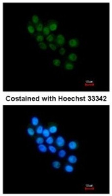 Immunocytochemistry/Immunofluorescence: FOXB1 Antibody [NBP2-16517] - Analysis of paraformaldehyde-fixed HepG2, using antibody at 1:200 dilution.