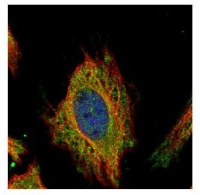 Immunocytochemistry/Immunofluorescence: FEM1C Antibody [NBP2-14955] - Analysis of methanol-fixed HeLa, using FEM1C antibody (Green) at 1:500 dilution. Alpha-tubulin filaments were labeled with an alpha Tubulin antibody (Red) at 1:2000.