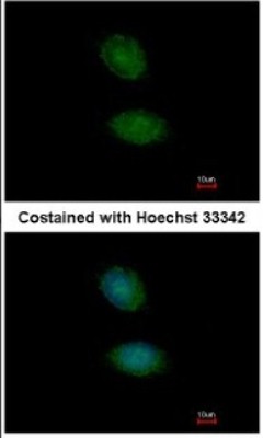 Immunocytochemistry/Immunofluorescence: AMMECR1 Antibody [NBP2-15377] - Paraformaldehyde-fixed HeLa, using antibody at 1:100 dilution.