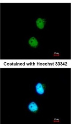 Immunocytochemistry/Immunofluorescence: LSM4 Antibody [NBP2-17182] - Analysis of paraformaldehyde-fixed HeLa, using antibody at 1:200 dilution.