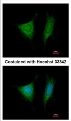 Immunocytochemistry/Immunofluorescence: TRIP1 Antibody [NBP2-16300] - Immunofluorescence analysis of methanol-fixed HeLa, using antibody at 1:200 dilution.