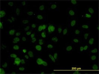 Immunocytochemistry/Immunofluorescence: SMARCD2 Antibody (2F7) [H00006603-M01] - Analysis of monoclonal antibody to SMARCD2 on HeLa cell. Antibody concentration 10 ug/ml.