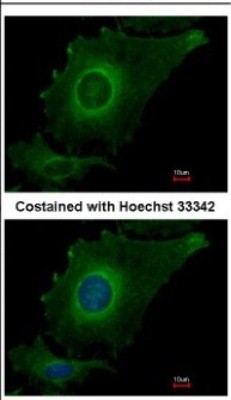 Immunocytochemistry/Immunofluorescence: FBXO4 Antibody [NBP2-21608] - Immunofluorescence analysis of methanol-fixed HeLa, using antibody at 1:500 dilution.