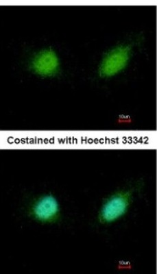 Immunocytochemistry/Immunofluorescence: Gabpb2 Antibody [NBP2-16572] - Analysis of paraformaldehyde-fixed HeLa, using antibody at 1:200 dilution.