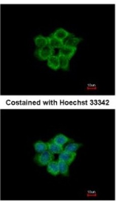 Immunocytochemistry/Immunofluorescence: ACOT11 Antibody [NBP2-15246] - Analysis of methanol-fixed A431, using antibody at 1:200 dilution.