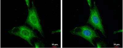 Immunocytochemistry/Immunofluorescence: Wnt-10a Antibody [NBP1-33039] - SKNSH cells were fixed in 4% paraformaldehyde at RT for 15 min. Green: WNT10A protein stained by WNT10A antibody [N1C1-2] diluted at 1:500. Blue: Hoechst 33342 staining.