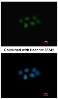 Immunocytochemistry/Immunofluorescence: MAT2B Antibody [NBP2-17230] - Immunofluorescence analysis of paraformaldehyde-fixed A431, using antibody at 1:200 dilution.