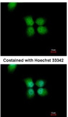 Immunocytochemistry/Immunofluorescence: ORC4L Antibody [NBP1-31132] - Paraformaldehyde-fixed A431, using antibody at 1:500 dilution.